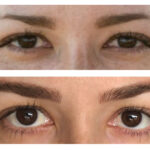 Andrea-Pedroso-Eyebrows-before-after